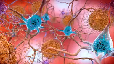 Alzheimer'a Karşı Yeni SHIELD Yöntemi